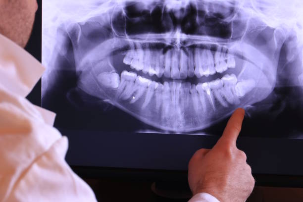 Best Emergency Dental Care for Broken or Chipped Teeth in Paloma Creek, TX
